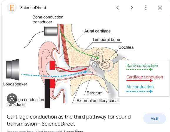 Gunsmith Hearing Loss Types 2 copy.png